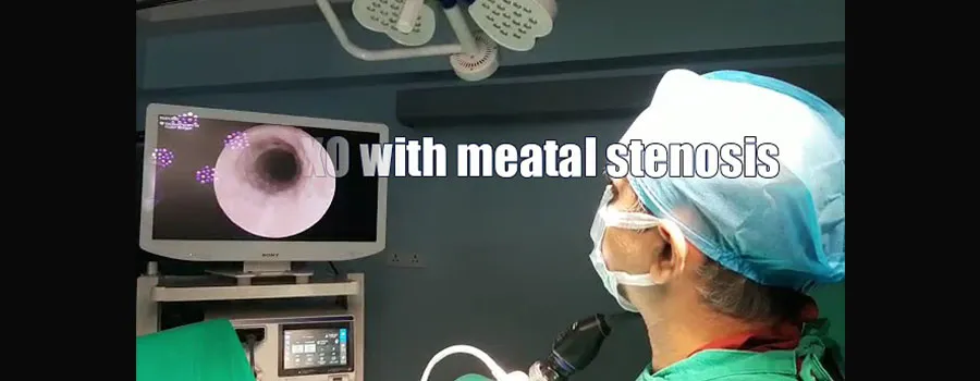 Excel Urology